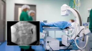 Fluoroscopically Guided injection