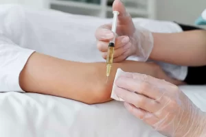 Platelet-Rich Plasma Therapy banner