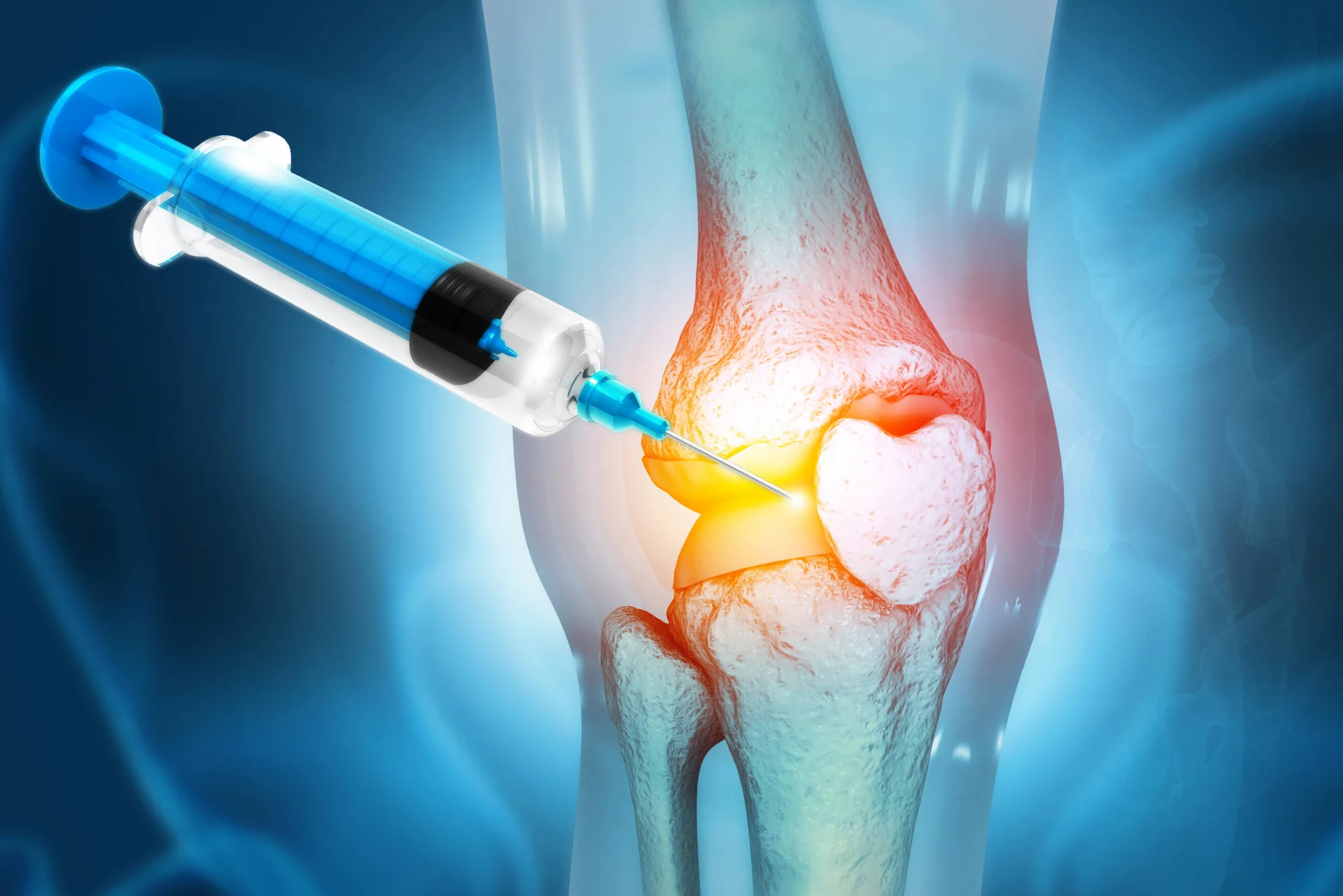 Intra-Articular Therapies banner