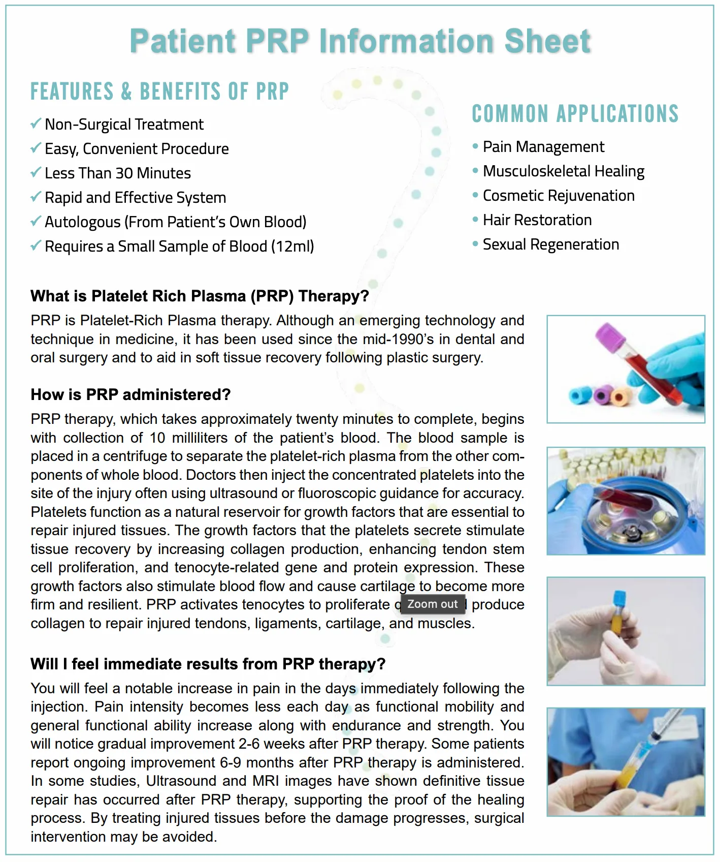 Patient PRP Information Sheet