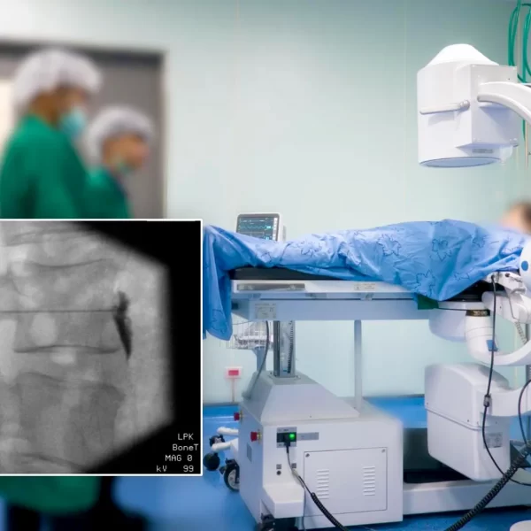 Fluoroscopically Guided injection