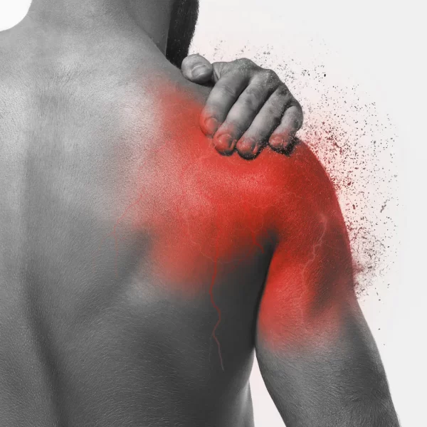 Shoulder Pain